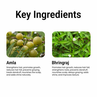 Multani Naturals Amla & Bhringraj Shampoo | Hair Growth, Dandruff Control & Scalp Irritation Relief | Paraben & SLS Free | Dermatologically Tested | 270ml