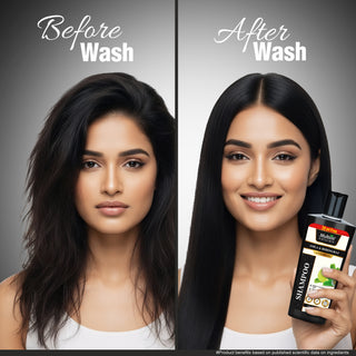 Multani Naturals Amla & Bhringraj Shampoo | Hair Growth, Dandruff Control & Scalp Irritation Relief | Paraben & SLS Free | Dermatologically Tested | 270ml