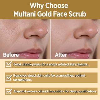 Multani Naturals Gold Face Scrub | For Gently Exfoliates & Unclogs Pores