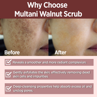 Multani Naturals Womens Night Care Gift Sets (Face Scrub| Toner| Body Lotion)